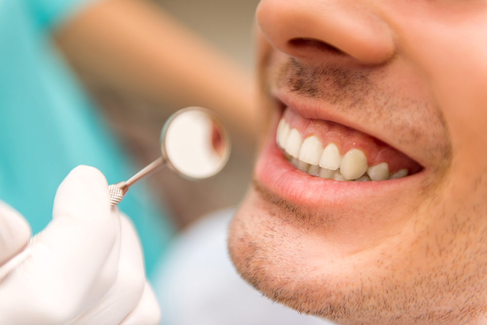 Whitening Results Check, Norfolk Dental Office Close-up of a man's bright smile being checked with a dental mirror after a whitening visit in Norfolk