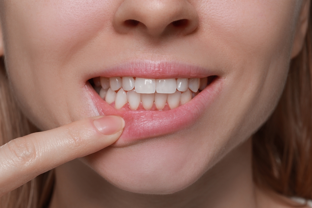 Young woman showing healthy gums, closeup view