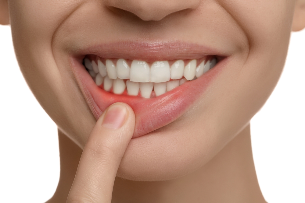 Young woman showing inflamed gums, closeup view