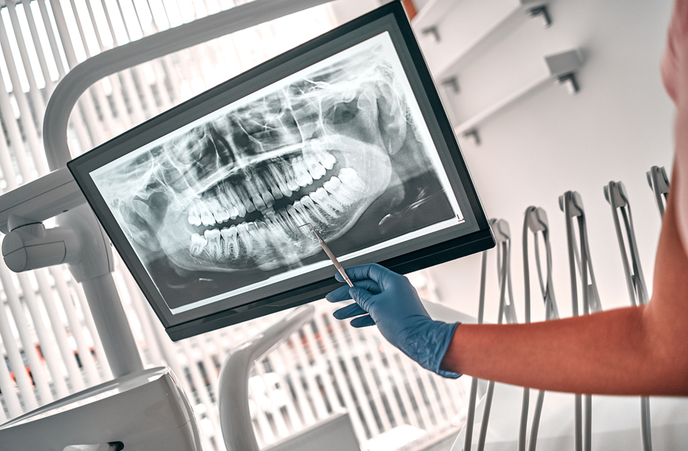 Digital x-ray review: Norfolk dental office Dentist reviewing a full mouth digital x-ray on an in-office monitor at our Norfolk dental office