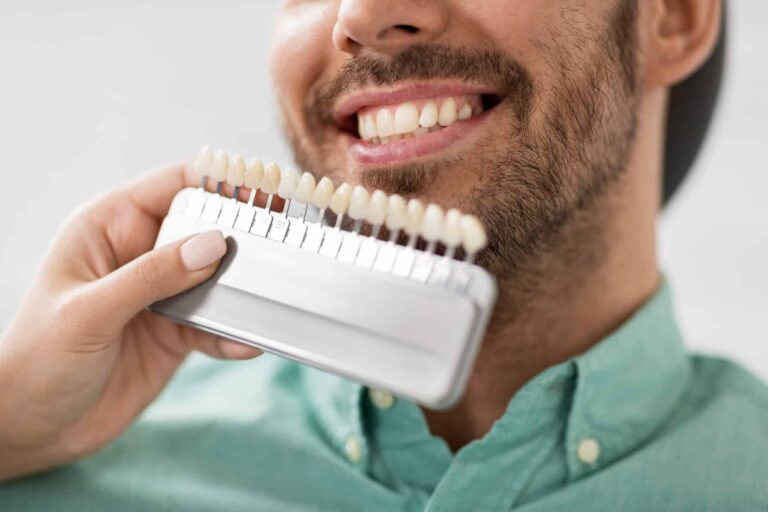 Man smiling as a veneer shade guide is held against his teeth during a cosmetic consultation at The Foleck Center, Virginia Beach, VA 